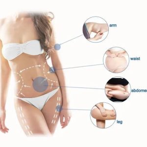 Liposonix treatment