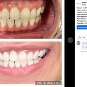 Real Results By non other SKINKOK