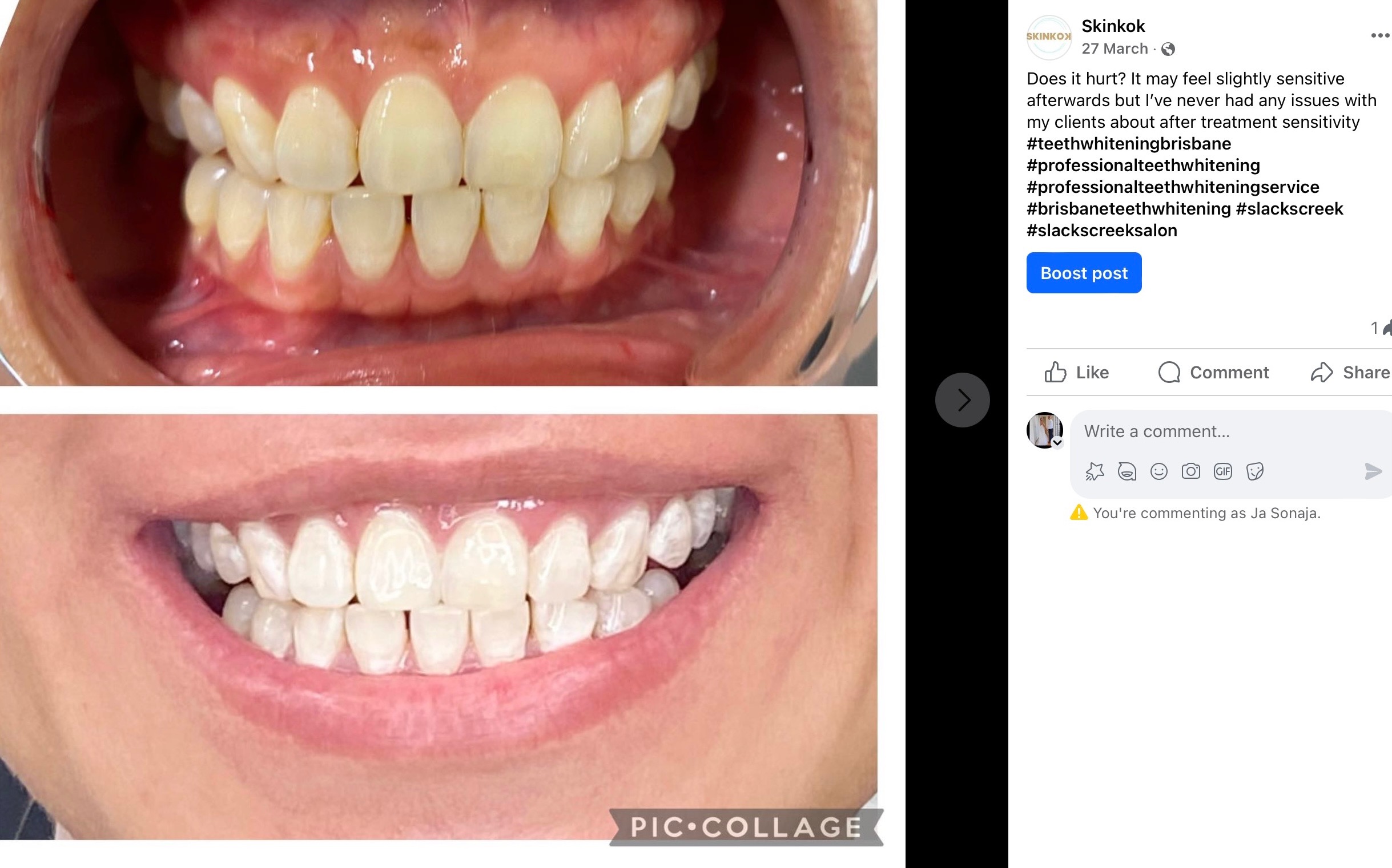 Real Results By non other SKINKOK